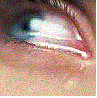 eye1.GIF
